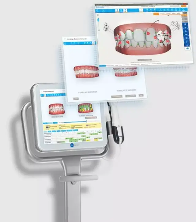 说说口碑不错的牙齿矫正机构柳州中瑞口腔性价比排名(图1)