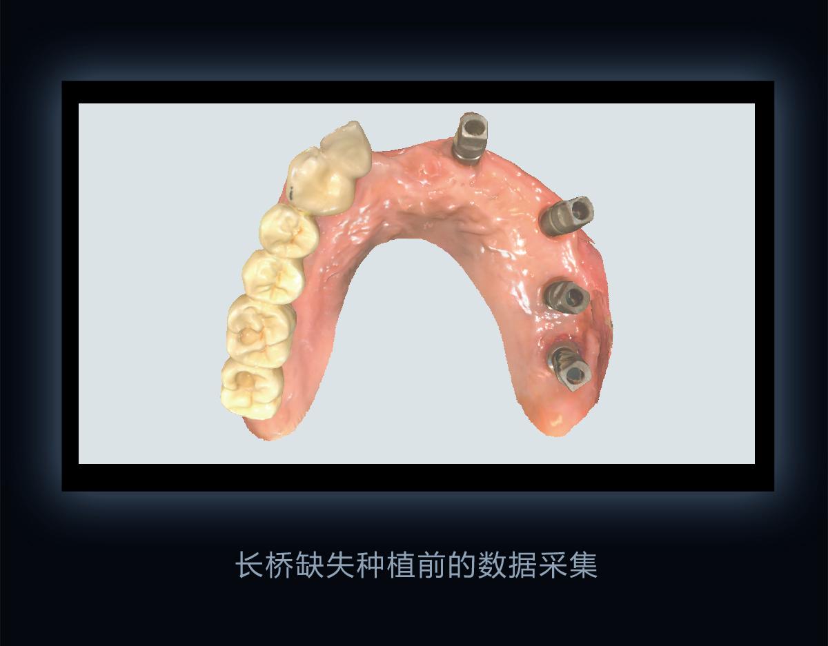 说说柳州中瑞口腔口腔健康管理服务好用吗(图1)