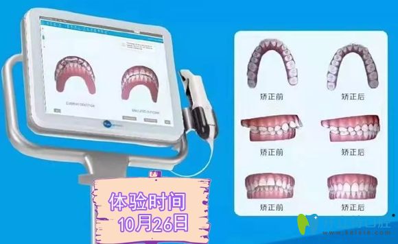 口腔光学扫描仪操作步骤(图1)